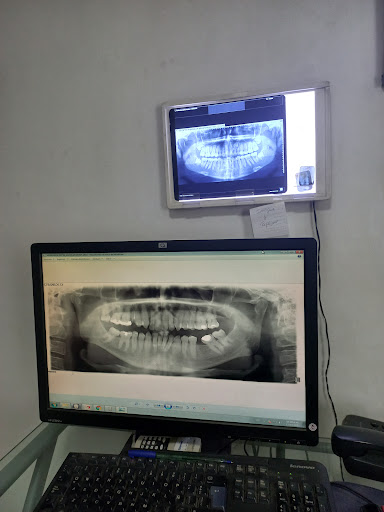 Radiografías Dentales - Panoramix - Centro Radiológico Maxilofacial - Panorámica